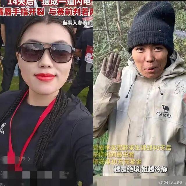 女子參加湖南荒野求生，14天后瘦成一道閃電，嘴唇手指裂開:商貿
